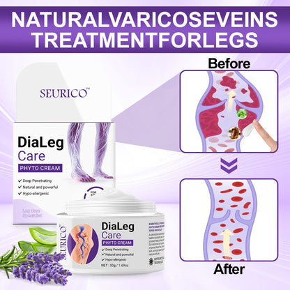👨‍⚕️ Seurico™ 𝐃𝐢𝐚𝐋𝐞𝐠 𝐂𝐚𝐫𝐞 𝐏𝐡𝐲𝐭𝐨 𝐂𝐫𝐞𝐚𝐦 - Visible results in 2 days – Relieves swelling and pain