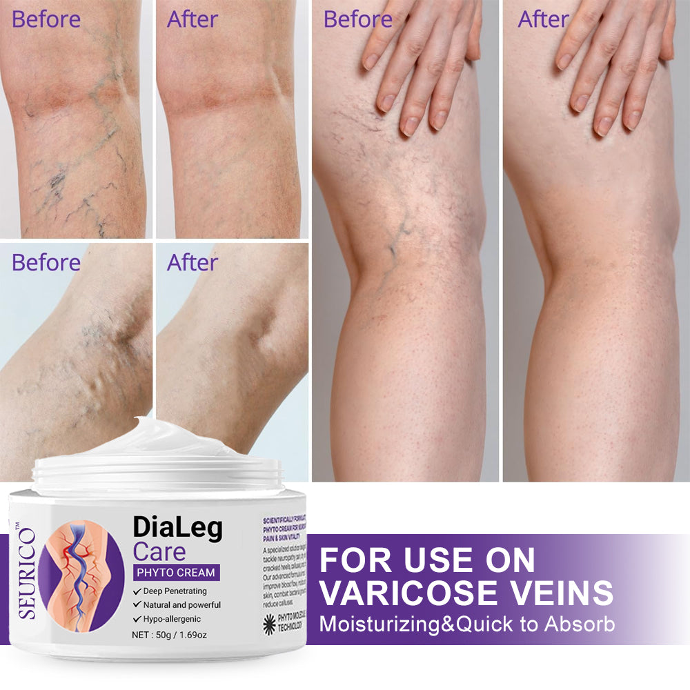 👨‍⚕️ Seurico™ 𝐃𝐢𝐚𝐋𝐞𝐠 𝐂𝐚𝐫𝐞 𝐏𝐡𝐲𝐭𝐨 𝐂𝐫𝐞𝐚𝐦 - Visible results in 2 days – Relieves swelling and pain