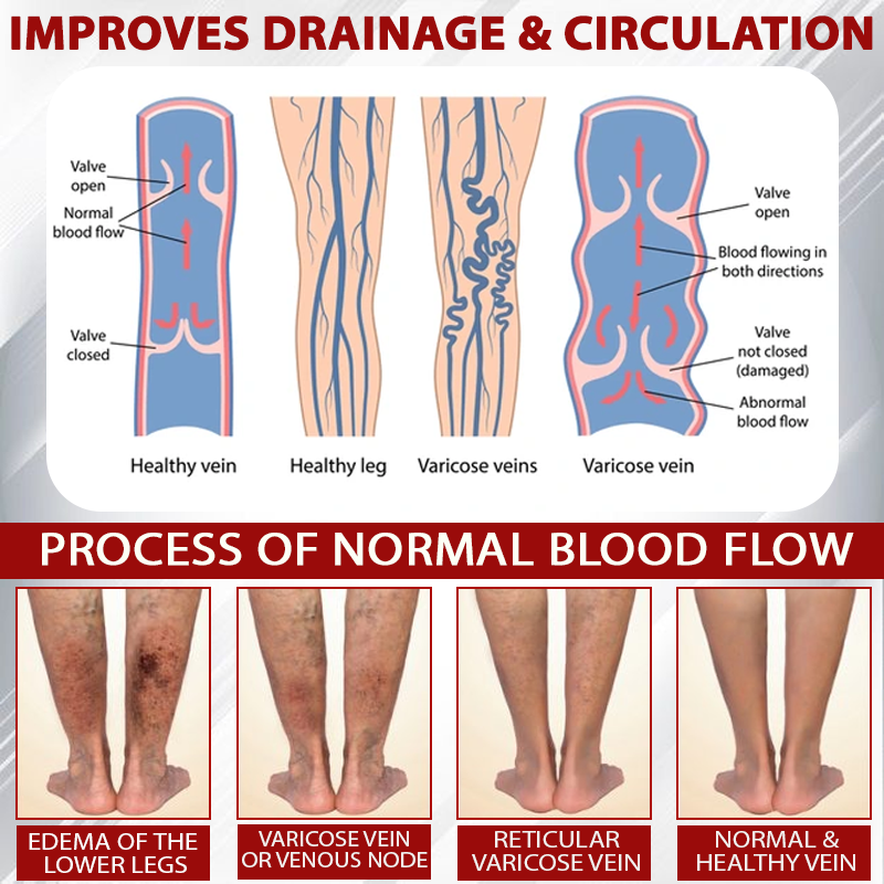 ODEIUN™ Advanced CVI Edema Therapy Cream