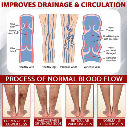 ODEIUN™ Advanced CVI Edema Therapy Cream