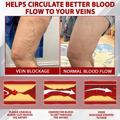 ODEIUN™ Advanced CVI Edema Therapy Cream