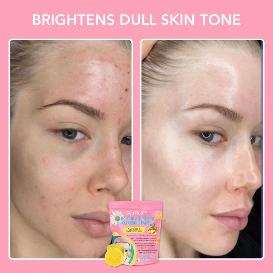 Seurico™ Turmeric Kojic Acid Cleansing Pads