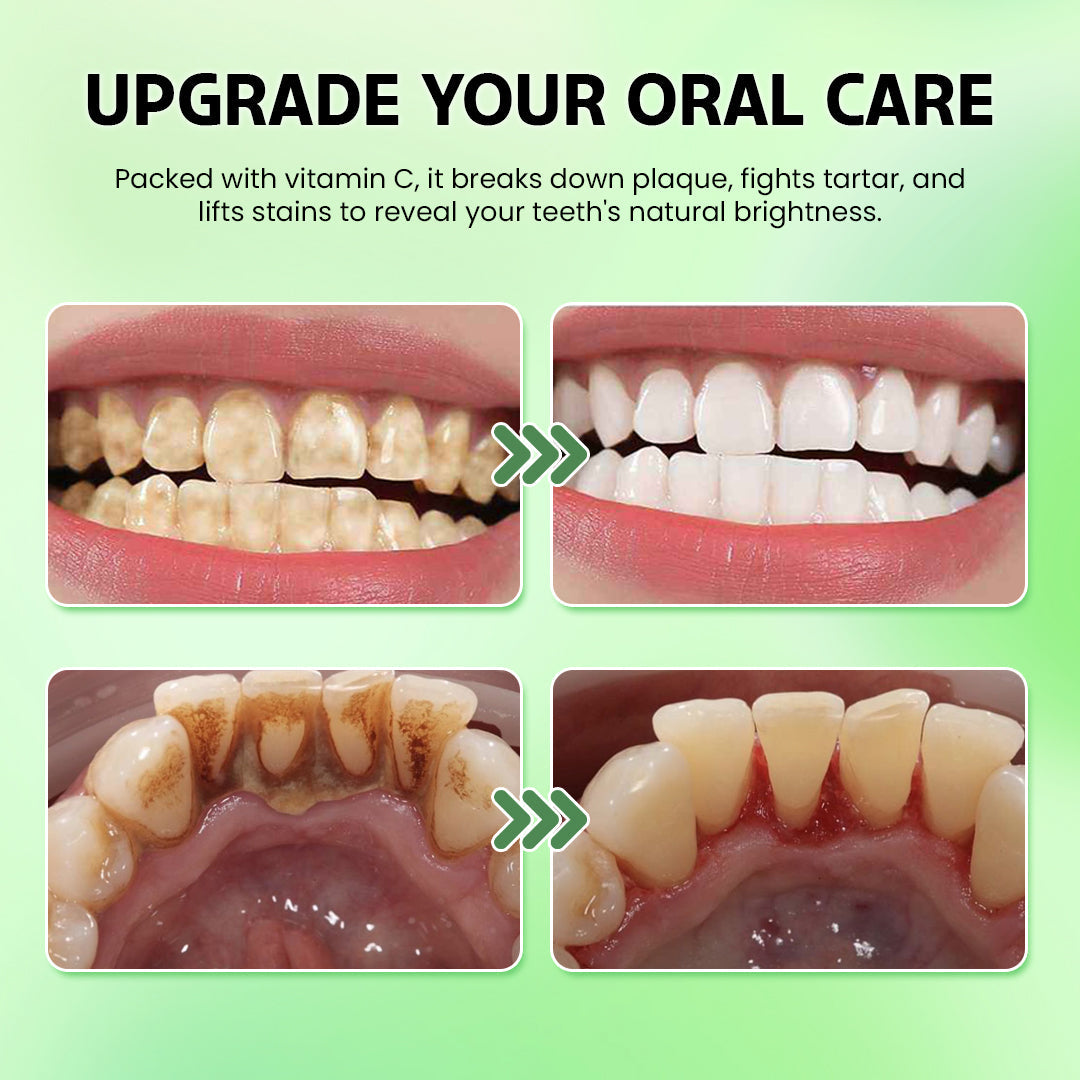 🛡️ Odalt™: Rebuild & Restore Your Smile with Hydroxyapatite