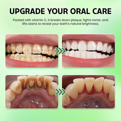 🛡️ Odalt™: Rebuild & Restore Your Smile with Hydroxyapatite