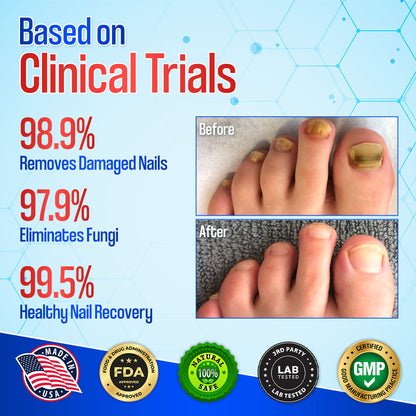 Zakdavi™ Anti-Fungal Nail Repair Patches✨ Say Goodbye to Nail Fungus in Days! 💅🍃