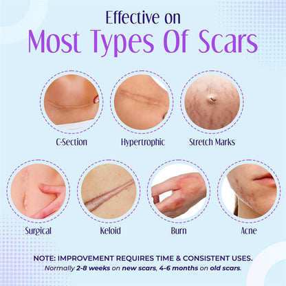 ✅Official Store |Negusy™ Hyaluronic Acid Nano Microneedle Repair Tape💷✴️(Treatment of old and new scars, reduction of surgical scars, stretch marks, keloids, acne, burns, warts, dermatomes and varicose veins)