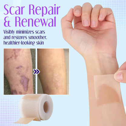 ✅Official Store |Negusy™ Hyaluronic Acid Nano Microneedle Repair Tape💷✴️(Treatment of old and new scars, reduction of surgical scars, stretch marks, keloids, acne, burns, warts, dermatomes and varicose veins)