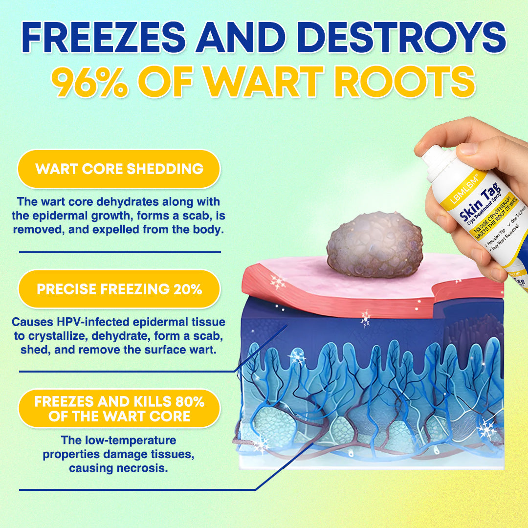 ❄️ LBMLBM™ Skin Tag Cryo Treatment Spray — Fast Freezing At-Home Removal ✨