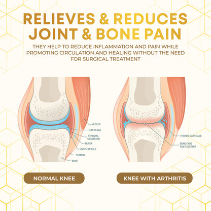 Seurico™ Bee Venom Joint Therapy Pain Relief Gel 🐝🔥