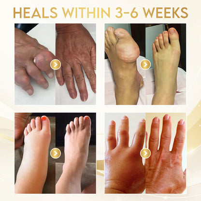 Odeiun™ Orthopedic Cream | AAOS-Inspired Pain Relief & Bone Support with Bee Venom + Botulinum