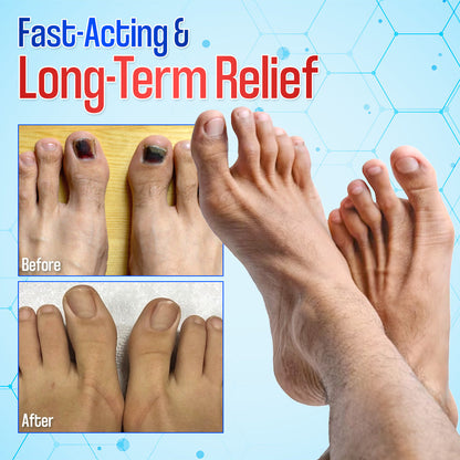 Zakdavi™ Anti-Fungal Nail Repair Patches✨ Say Goodbye to Nail Fungus in Days! 💅🍃