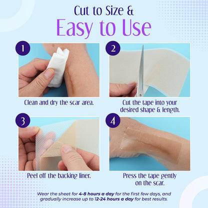 ✅Official Store |Negusy™ Hyaluronic Acid Nano Microneedle Repair Tape💷✴️(Treatment of old and new scars, reduction of surgical scars, stretch marks, keloids, acne, burns, warts, dermatomes and varicose veins)