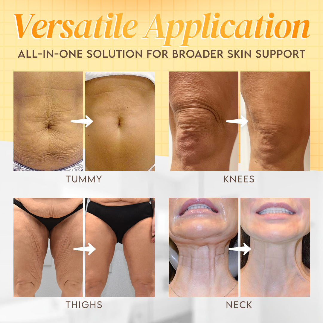 🔥Made and Shipped from USA ✨ Venolift™ Bee venom Comprehensive Cream 🔥 LAST DAY 80% OFF