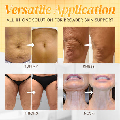 🔥Made and Shipped from USA ✨ Venolift™ Bee venom Comprehensive Cream 🔥 LAST DAY 80% OFF