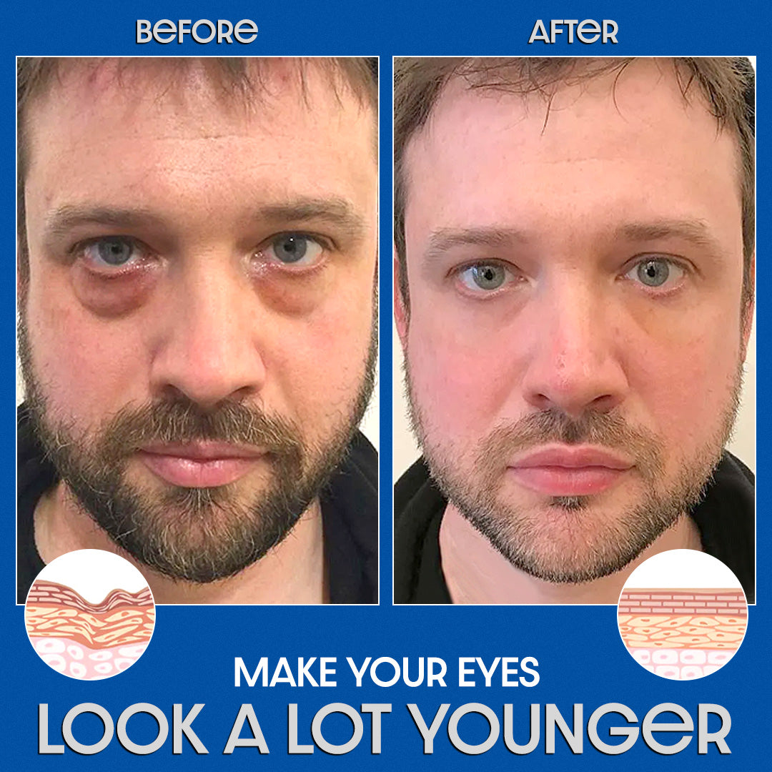 Odeiun™ Peptide PowerLift Eye Gel