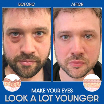 Odeiun™ Peptide PowerLift Eye Gel