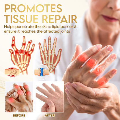 Comfort for Joints ⚡ | Odeiun™ Orthopedic Cream • Bee Venom + Botulinum • AAOS-Inspired