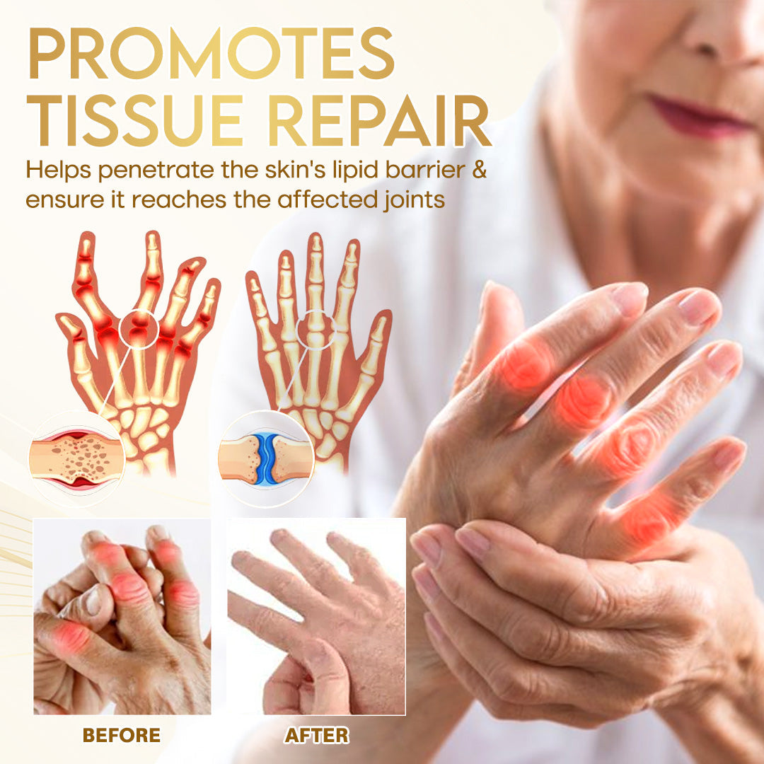 Odeiun™ Orthopedic Cream | AAOS-Inspired Pain Relief & Bone Support with Bee Venom + Botulinum