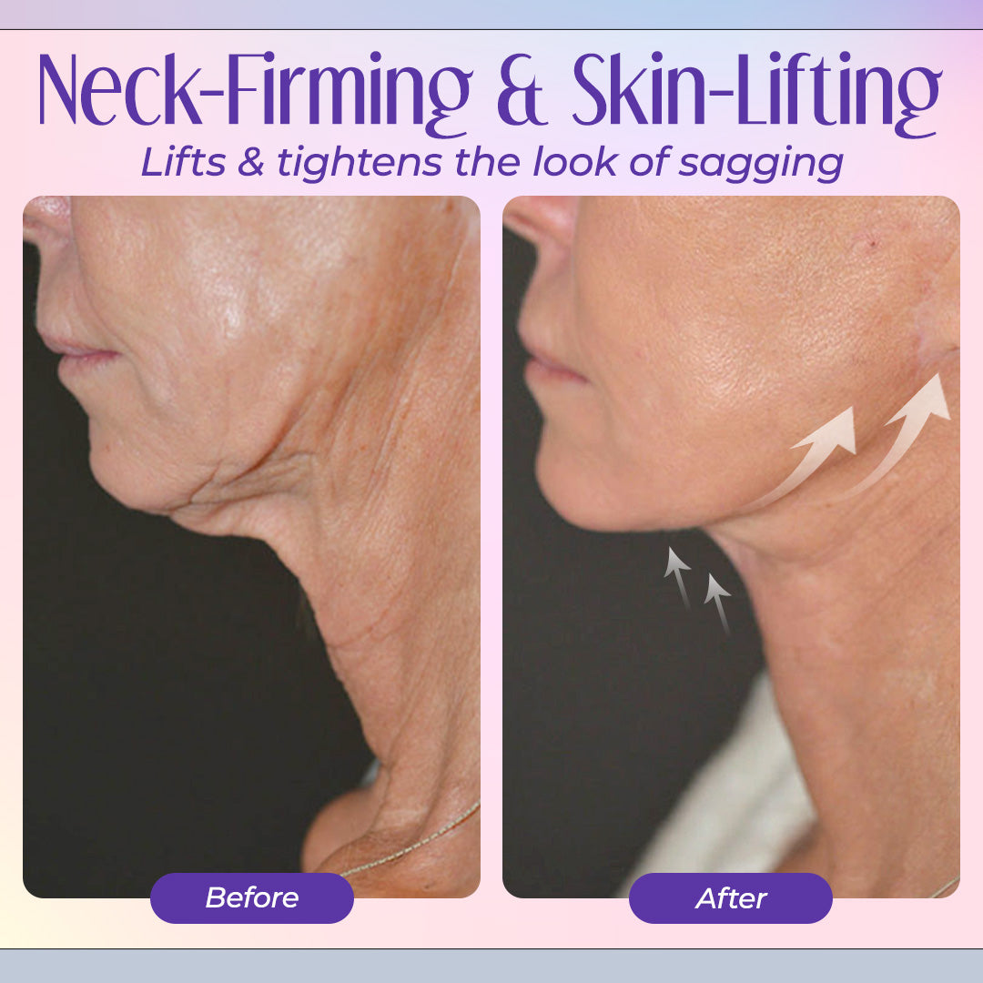 🌸 Seurico™ Miracle Neck Cream: Erase "Turkey Neck" & "Tech Neck" Lines Visible Lift & Smoothness in 4 Weeks