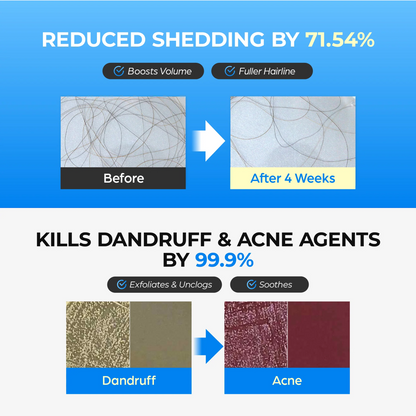 Odeiun™ Botanical Hair Growth Serum with Roll-On Applicator