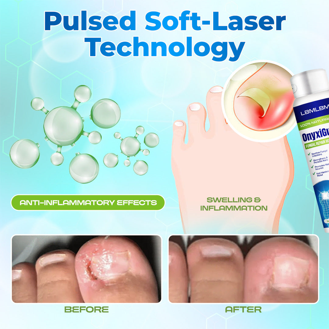 Lbmlbm® OnyxiGuard Fungal Repair Herbal Spray – 🌿 Natural Treatment for Healthy, Revitalized Skin & Nails ✨