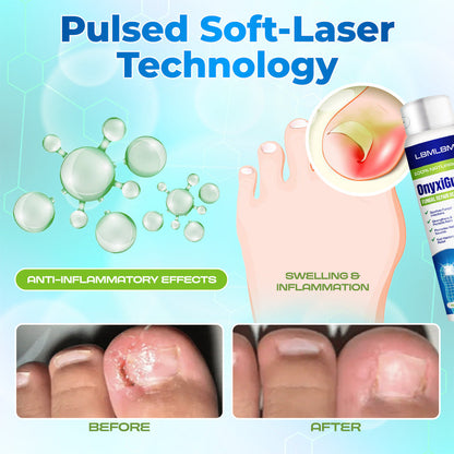 Lbmlbm® OnyxiGuard Fungal Repair Herbal Spray – 🌿 Natural Treatment for Healthy, Revitalized Skin & Nails ✨