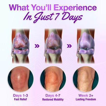 👨‍⚕️Official Store: Seurico™ Turmeric & Emu Oil Arthritis Soothing Pain Relief Massage Gel 👨‍⚕️American Orthopaedics (AAOS) Approved