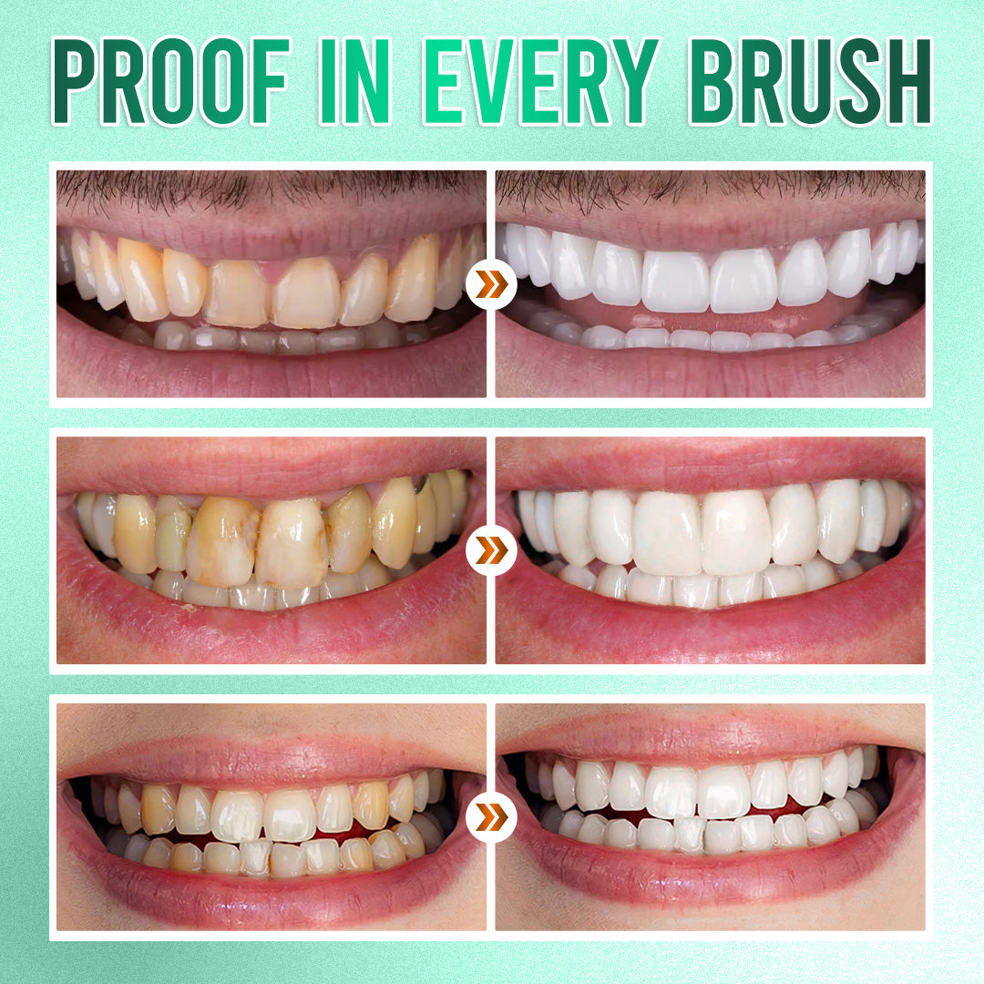 ✨ 360° Tri-Head Toothbrush: The Ultimate Clean for Braces & Sensitive Gums 🦷