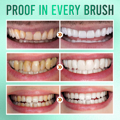 ✨ 360° Tri-Head Toothbrush: The Ultimate Clean for Braces & Sensitive Gums 🦷