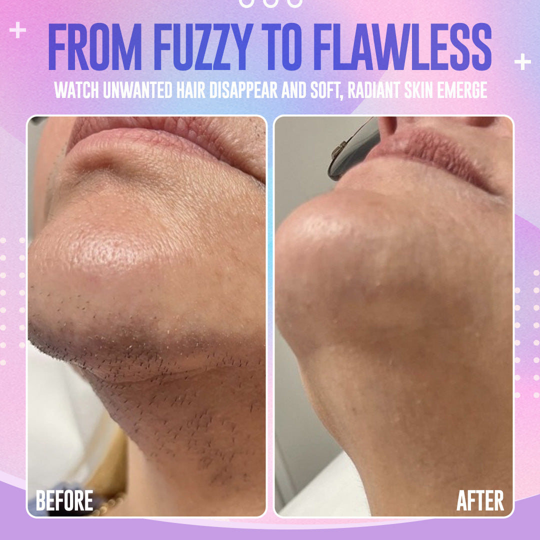 ODEIUN® Gentle and Painless Facial Hair Removal Cream– Limited Time Offer for Smooth, Flawless Skin ✨