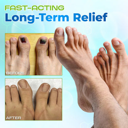 Lbmlbm® OnyxiGuard Fungal Repair Herbal Spray – 🌿 Natural Treatment for Healthy, Revitalized Skin & Nails ✨