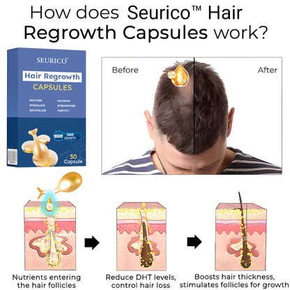 Seurico™ Hair Regrowth Capsules