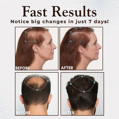 Odeiun™ Hair Renewal Capsules- Thicker, Fuller, Healthier Hair in Weeks