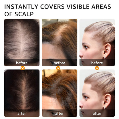 Zakdavi™ Instant Hairline & Root Concealer Powder — Natural, Waterproof Coverage for Fuller, Flawless Hair