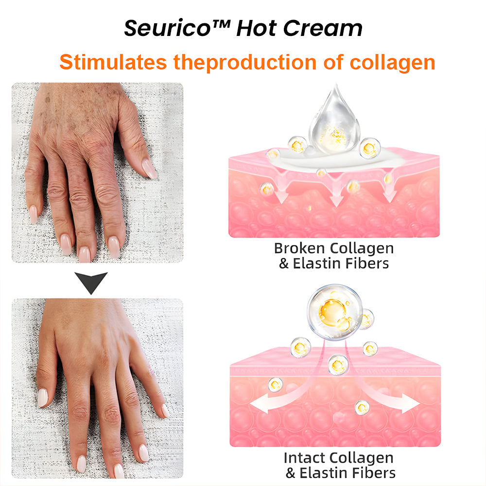 Seurico™ Hot Cream – Lift Saggy Skin, Reduce Wrinkles & Cellulite Fast