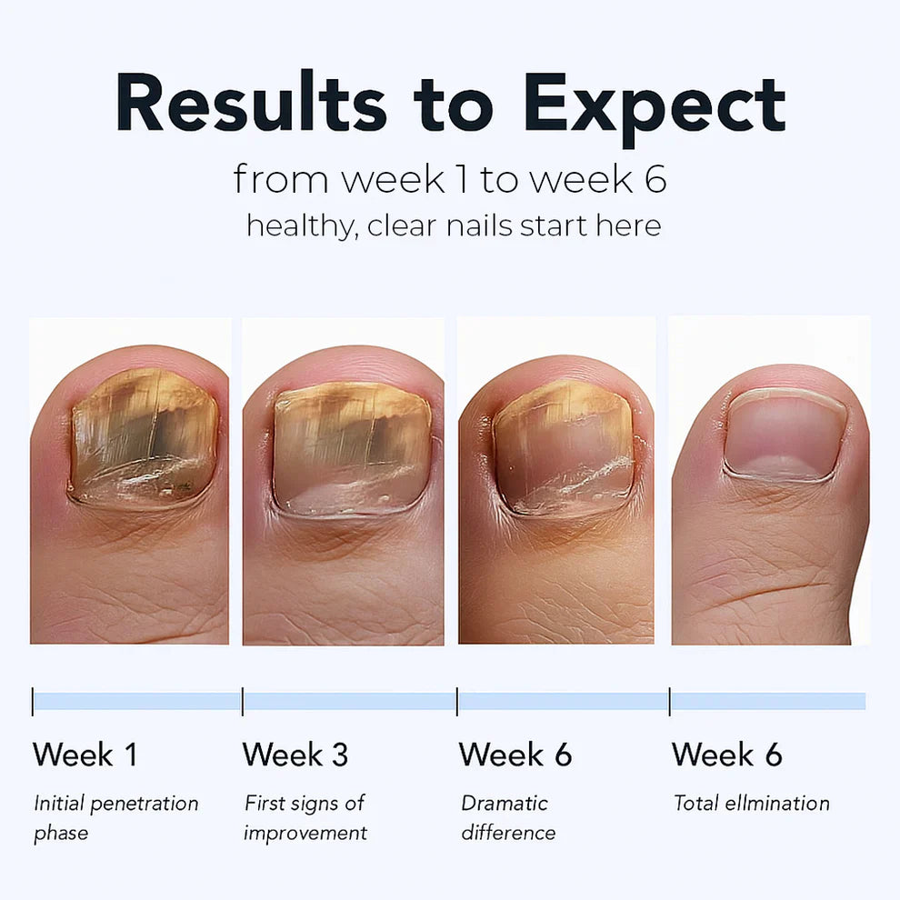 Odeiun™ - Fungal Nail Renewal Patches