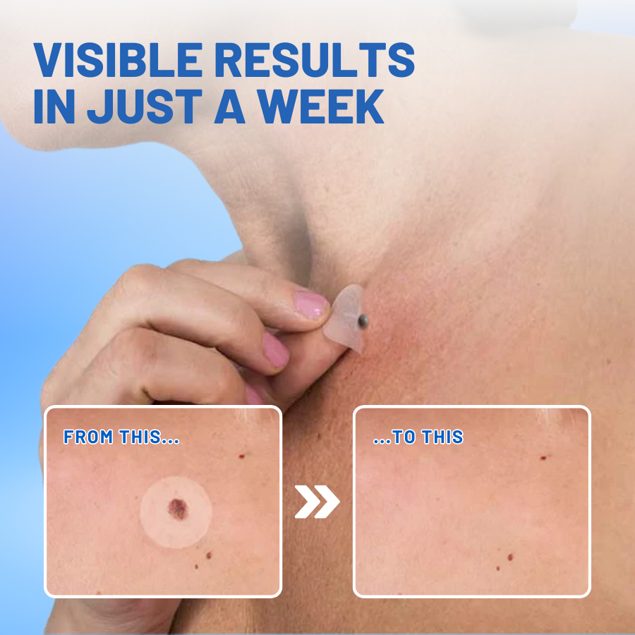 Jeremytis™ Moles & Warts Removing Skin Tag Patch