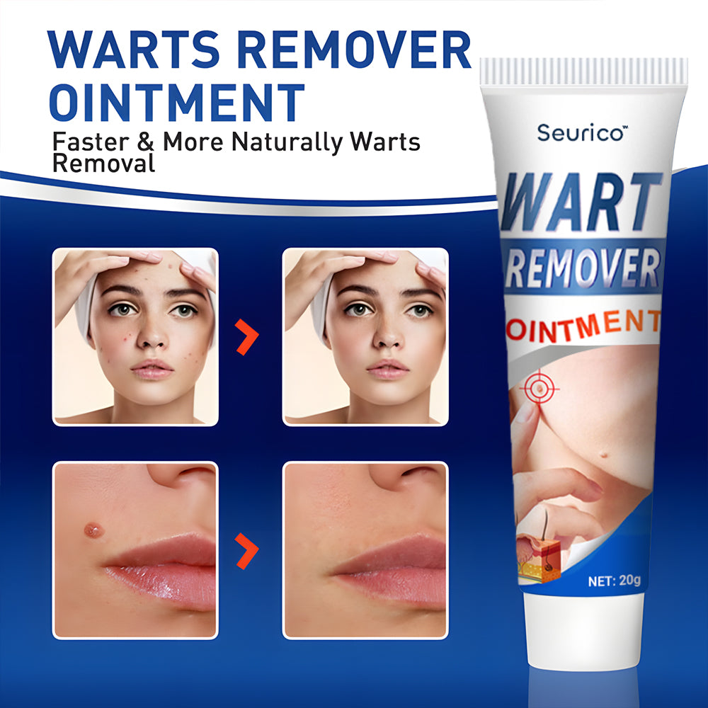 Seurico™ Instant Removal Cream