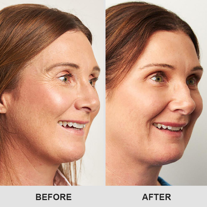 👁️ Seurico™ Retinol Eye Stick – Smooth Away Wrinkles, Puffiness & Dark Circles in Just Weeks!