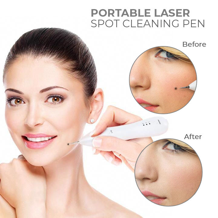 Seurico™ Portable Laser Spot Cleaning Pen