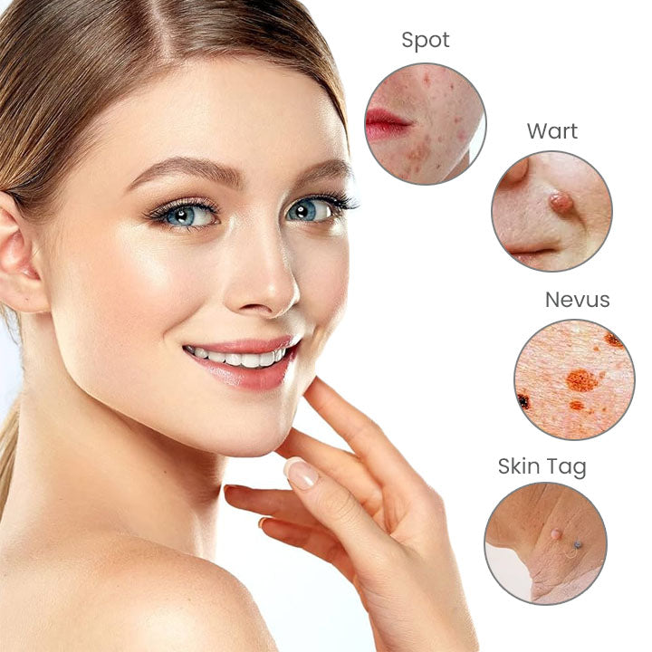 Seurico™ Portable Laser Spot Cleaning Pen