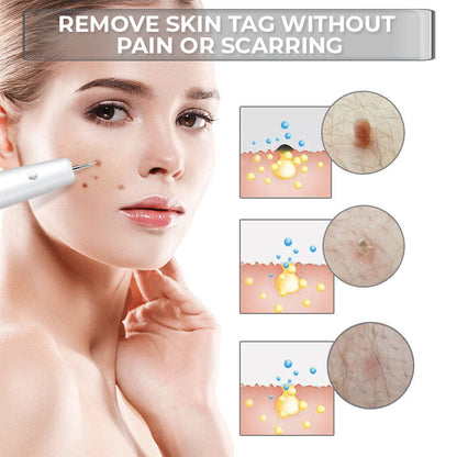 Seurico™ Portable Laser Spot Cleaning Pen