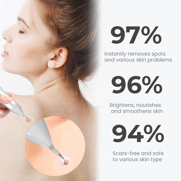 Seurico™ Portable Laser Spot Cleaning Pen