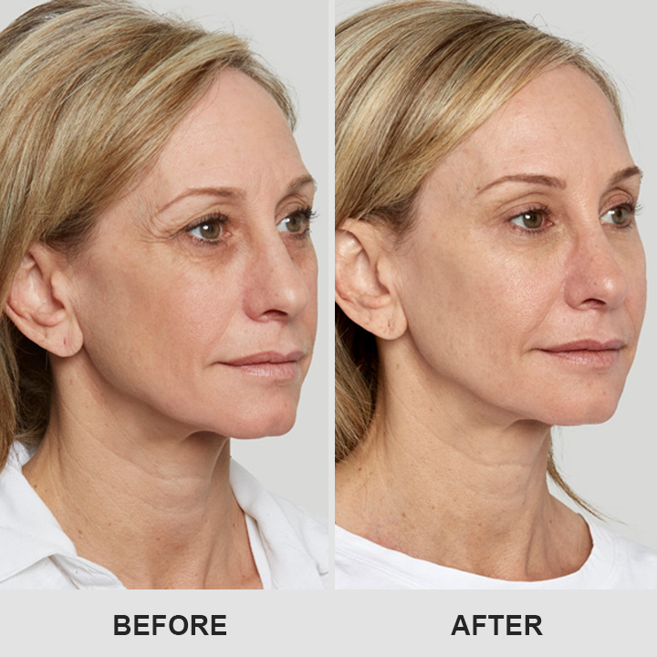 👁️ Seurico™ Retinol Eye Stick – Smooth Away Wrinkles, Puffiness & Dark Circles in Just Weeks!