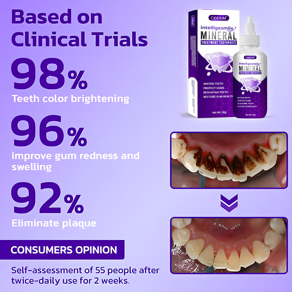 Odeiun™ IntelliSmile Mineral Treatment Toothpaste – Strengthen, Whiten, and Protect!