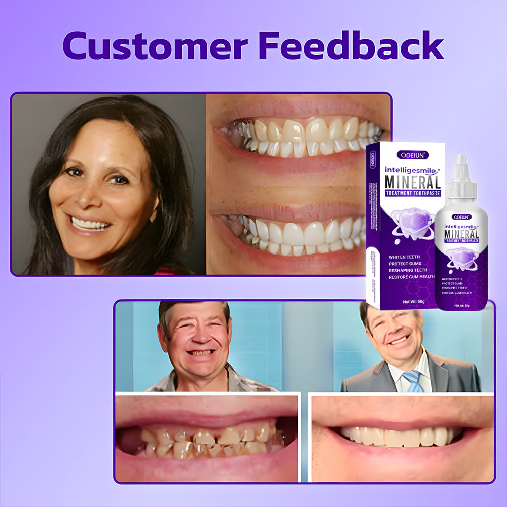 Odeiun™ IntelliSmile Mineral Treatment Toothpaste – Strengthen, Whiten, and Protect!
