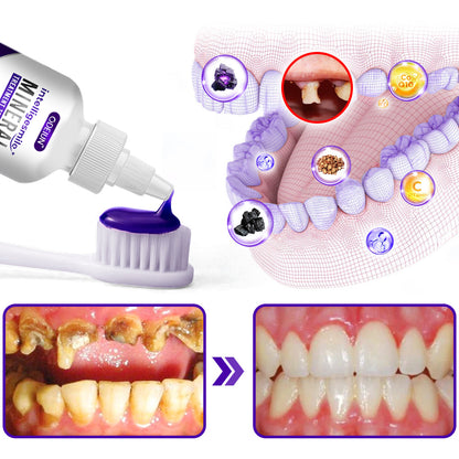 Odeiun™ IntelliSmile Mineral Treatment Toothpaste – Strengthen, Whiten, and Protect!