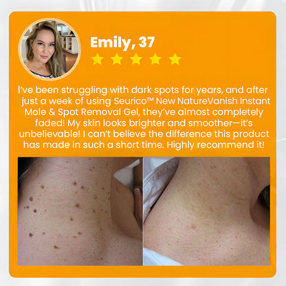 Seurico™ New NatureVanish Instant Mole & Spot Removal Gel