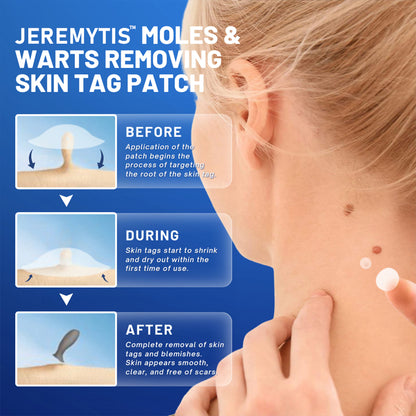 Jeremytis™ Moles & Warts Removing Skin Tag Patch