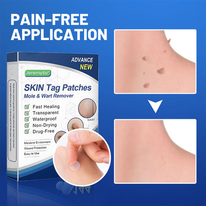Jeremytis™ Moles & Warts Removing Skin Tag Patch